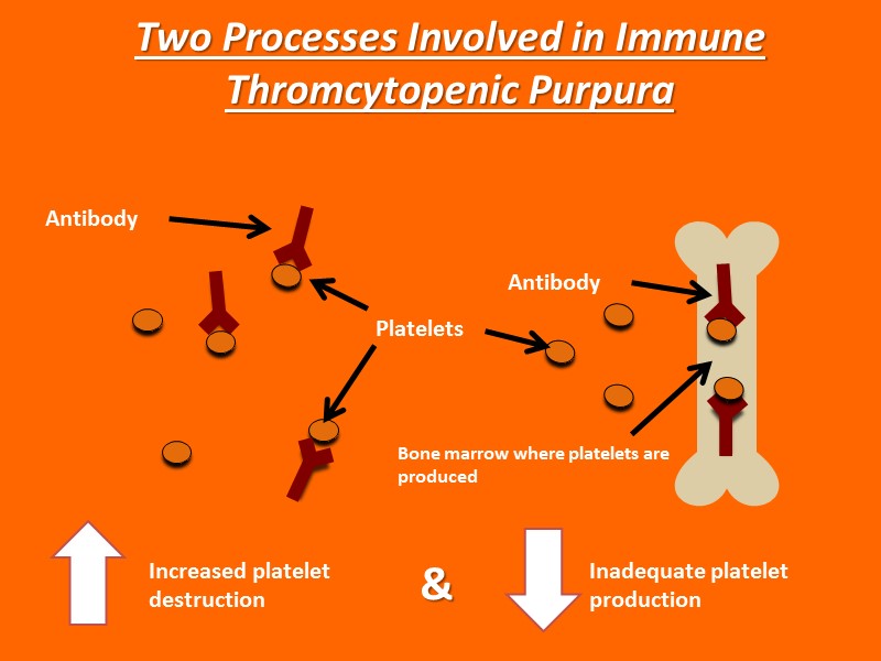 Increased platelet destruction & Inadequate platelet production Two Processes Involved in Immune Thromcytopenic Purpura